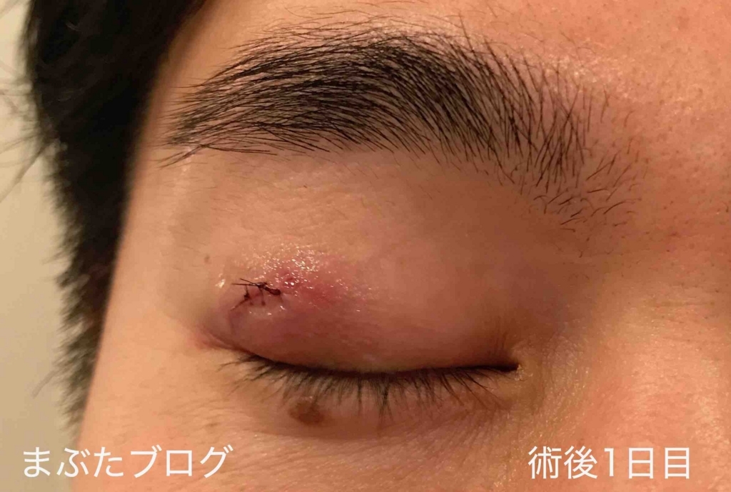 f:id:tomitooji:20180323120436j:plain