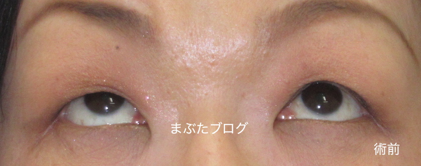f:id:tomitooji:20190601113905j:plain