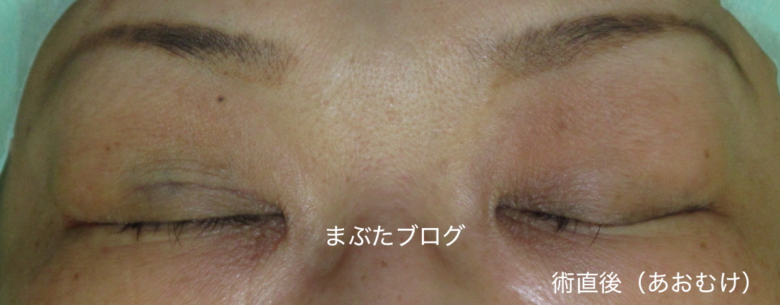 f:id:tomitooji:20190601115716j:plain