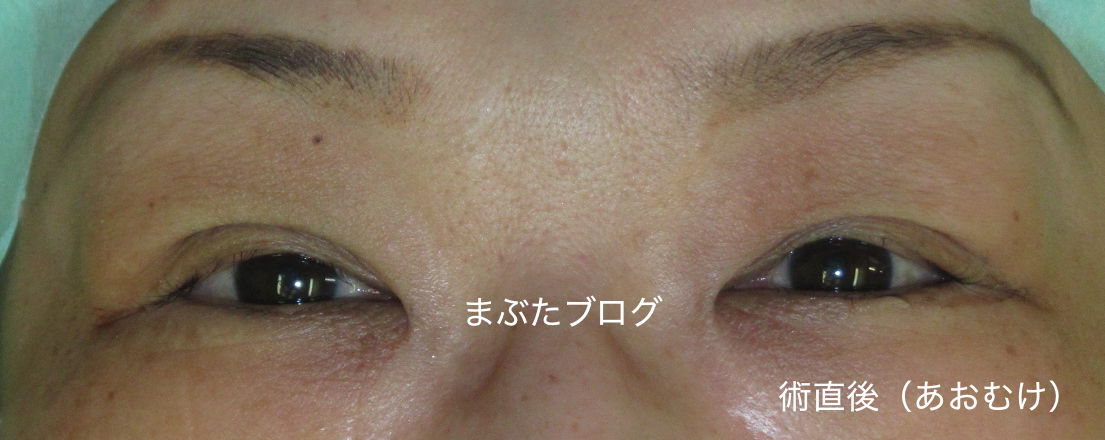 f:id:tomitooji:20190601120122j:plain