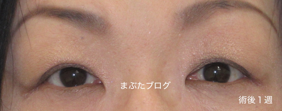 f:id:tomitooji:20190601120334j:plain