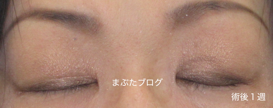 f:id:tomitooji:20190601120413j:plain