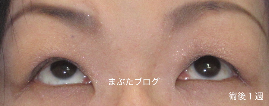 f:id:tomitooji:20190601120611j:plain