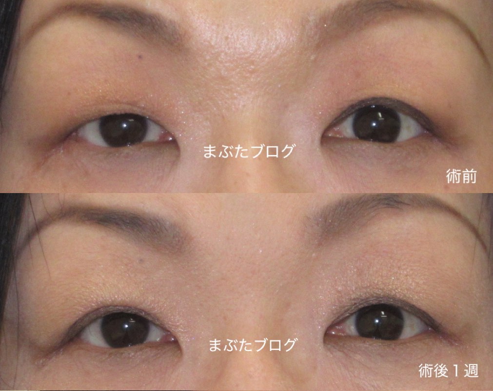 f:id:tomitooji:20190601122829j:plain