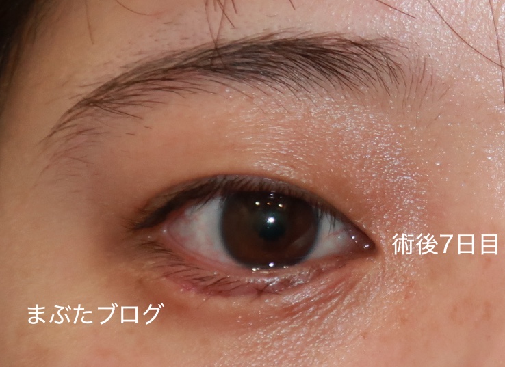 f:id:tomitooji:20191025150339j:plain