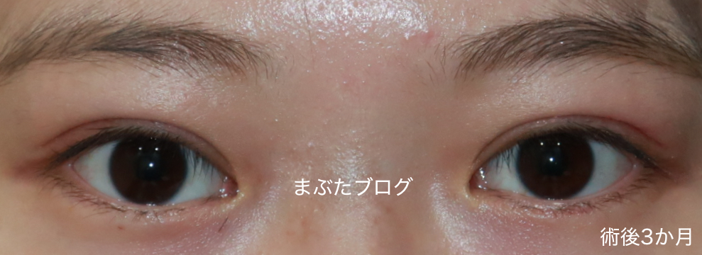 f:id:tomitooji:20191102174522j:plain f:id:tomitooji:20191102174522j:plain