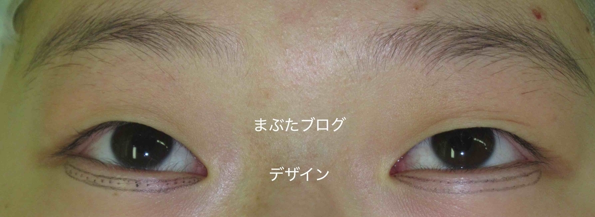 f:id:tomitooji:20191109123147j:plain f:id:tomitooji:20191109123147j:plain