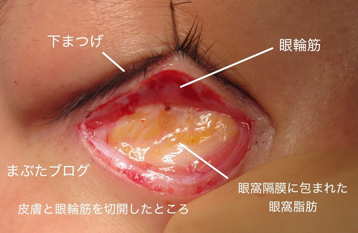 f:id:tomitooji:20191109123302j:plain f:id:tomitooji:20191109123302j:plain