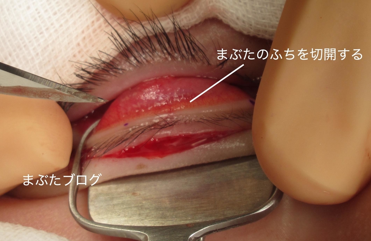 f:id:tomitooji:20191109124007j:plain f:id:tomitooji:20191109124007j:plain