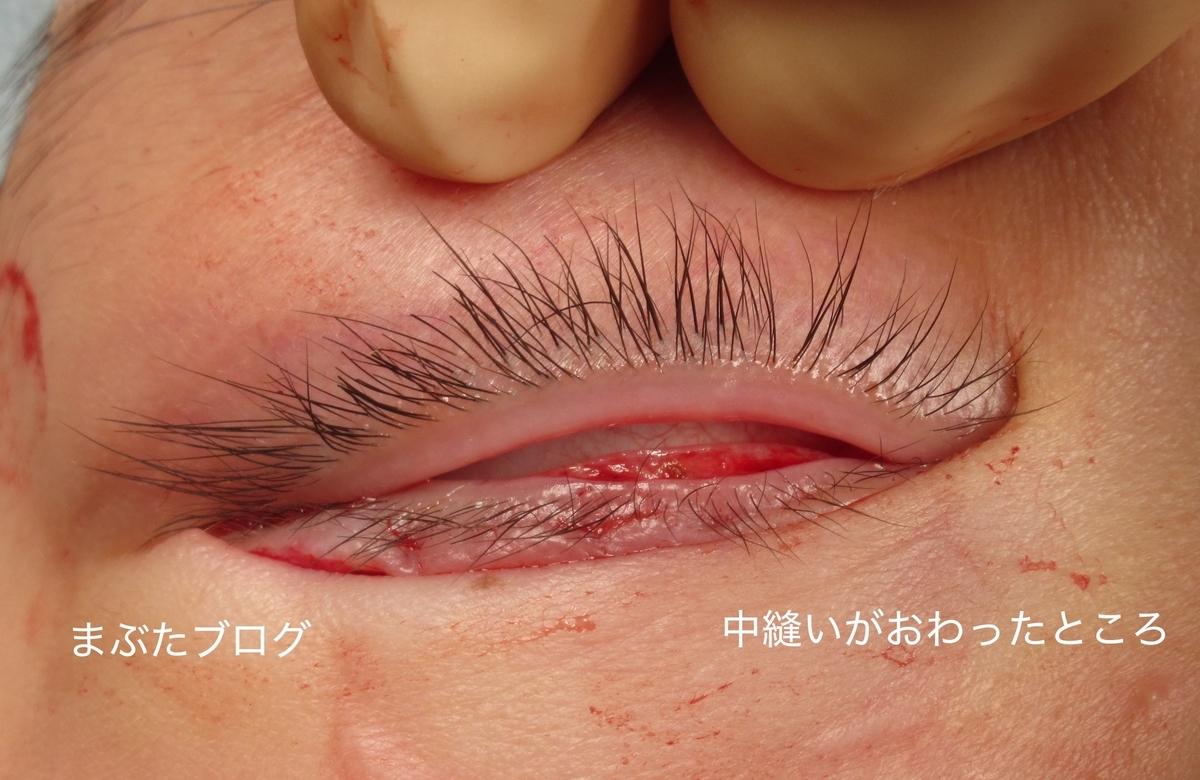 f:id:tomitooji:20191109124724j:plain f:id:tomitooji:20191109124724j:plain