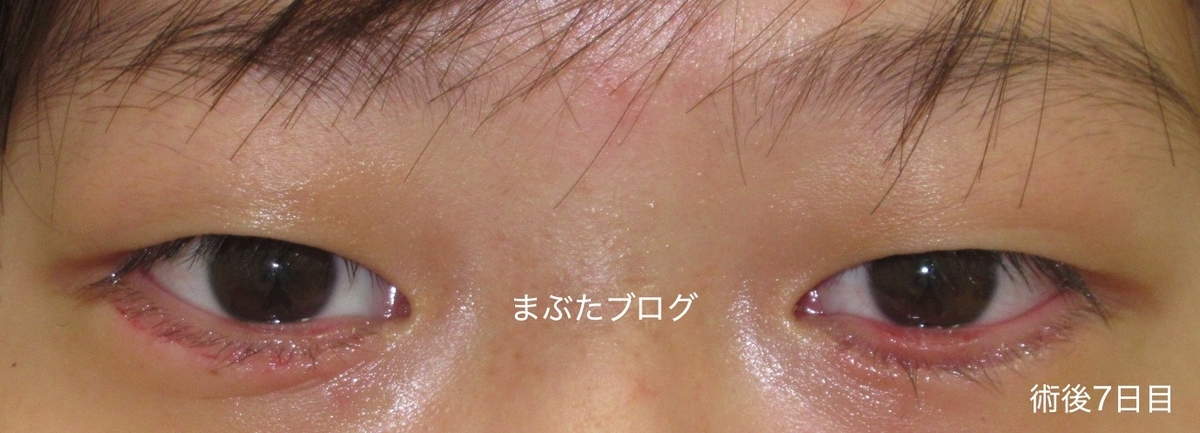 f:id:tomitooji:20191109125030j:plain f:id:tomitooji:20191109125030j:plain