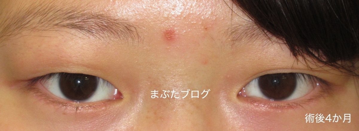f:id:tomitooji:20191109125314j:plain f:id:tomitooji:20191109125314j:plain