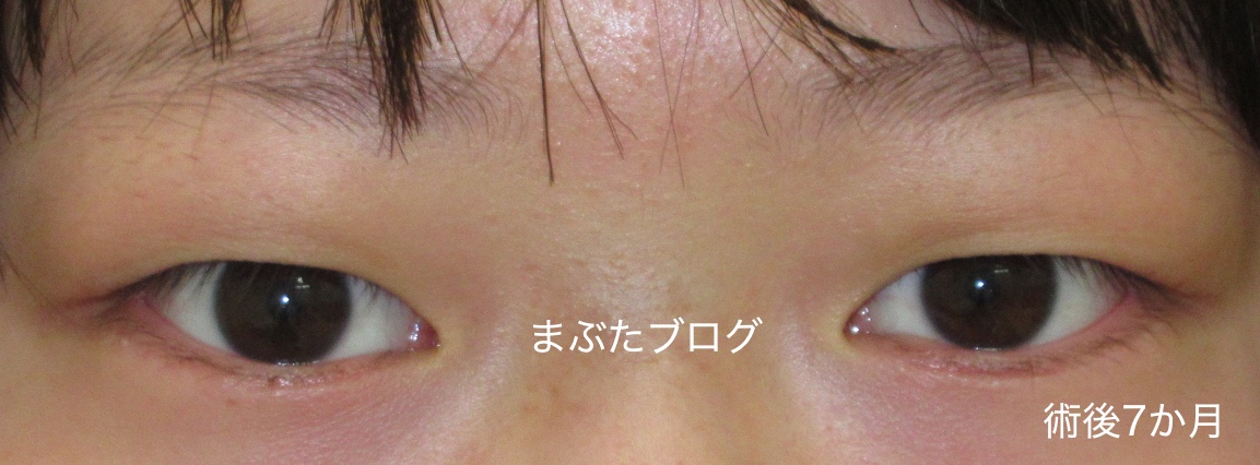 f:id:tomitooji:20191109140134j:plain f:id:tomitooji:20191109140134j:plain