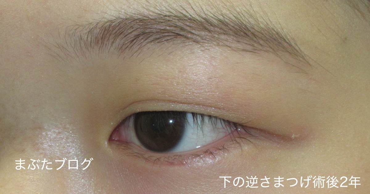 f:id:tomitooji:20191109140541j:plain f:id:tomitooji:20191109140541j:plain