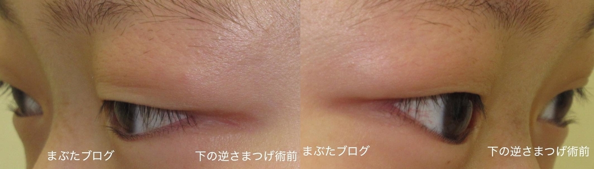f:id:tomitooji:20191109142844j:plain f:id:tomitooji:20191109142844j:plain