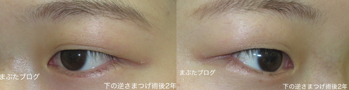 f:id:tomitooji:20191109142856j:plain f:id:tomitooji:20191109142856j:plain