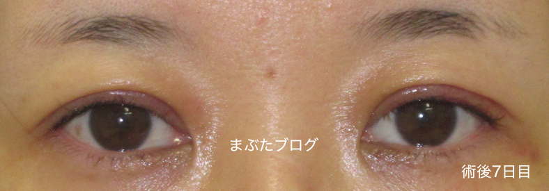 f:id:tomitooji:20191116153932j:plain