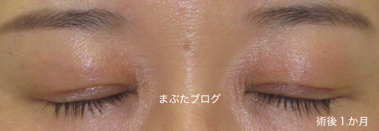 f:id:tomitooji:20191116154602j:plain