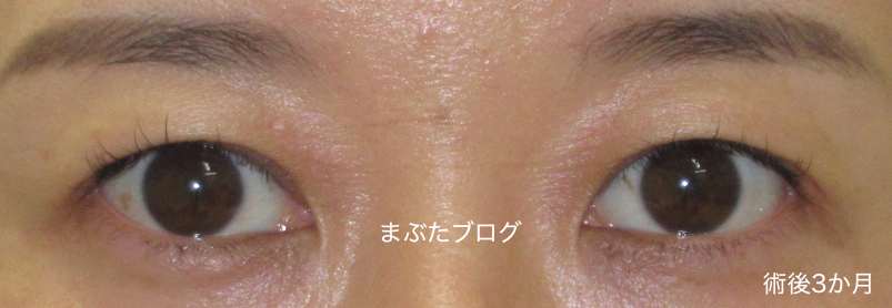 f:id:tomitooji:20191116155052j:plain