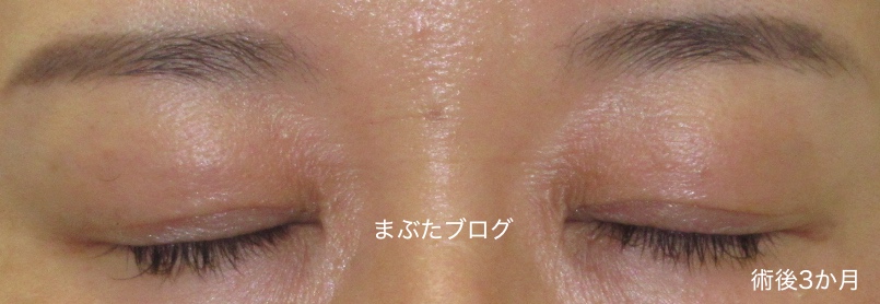 f:id:tomitooji:20191116155117j:plain