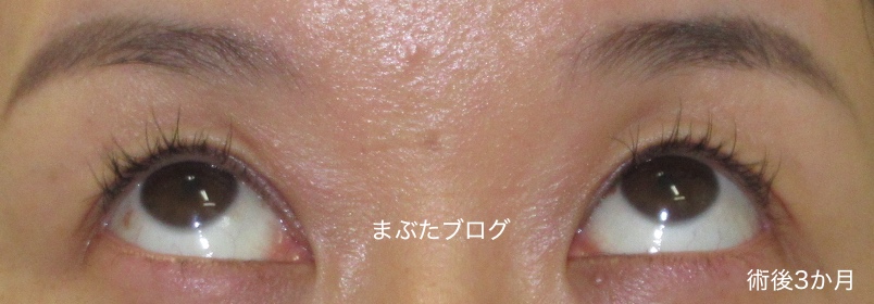 f:id:tomitooji:20191116155140j:plain