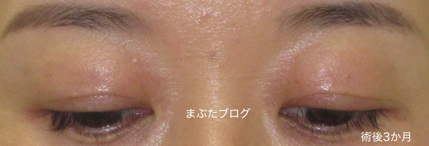 f:id:tomitooji:20191116155203j:plain