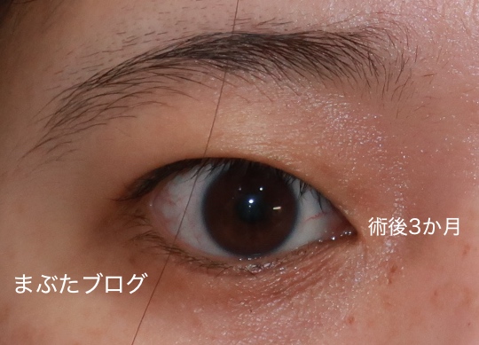 f:id:tomitooji:20200207185347j:plain