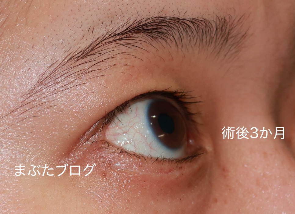 f:id:tomitooji:20200207185448j:plain
