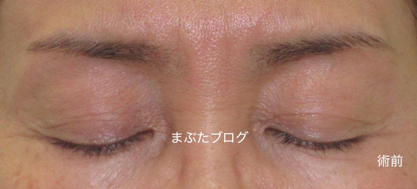 f:id:tomitooji:20200328171630j:plain