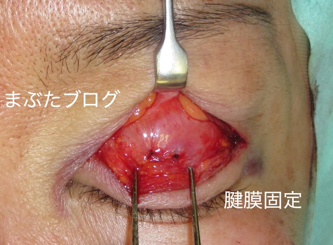 f:id:tomitooji:20200328172455j:plain