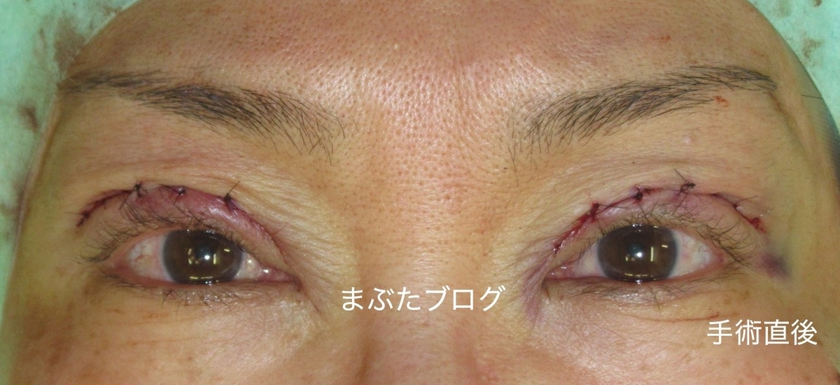 f:id:tomitooji:20200328172907j:plain