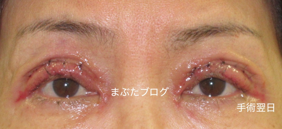 f:id:tomitooji:20200328173035j:plain