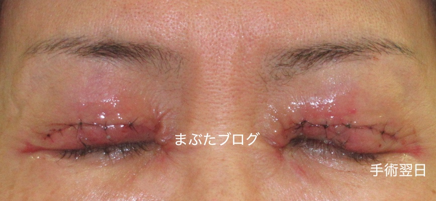 f:id:tomitooji:20200328173054j:plain