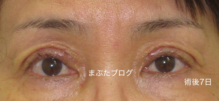 f:id:tomitooji:20200328173259j:plain