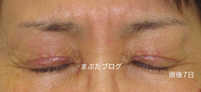 f:id:tomitooji:20200328173324j:plain