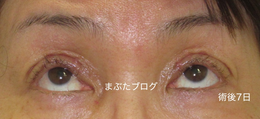 f:id:tomitooji:20200328173405j:plain