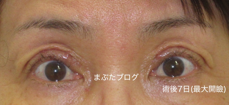 f:id:tomitooji:20200328173420j:plain