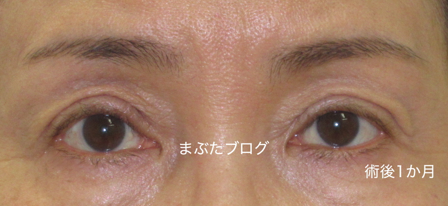 f:id:tomitooji:20200328173648j:plain