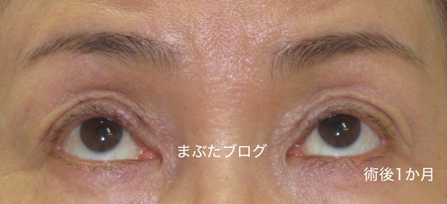 f:id:tomitooji:20200328173818j:plain