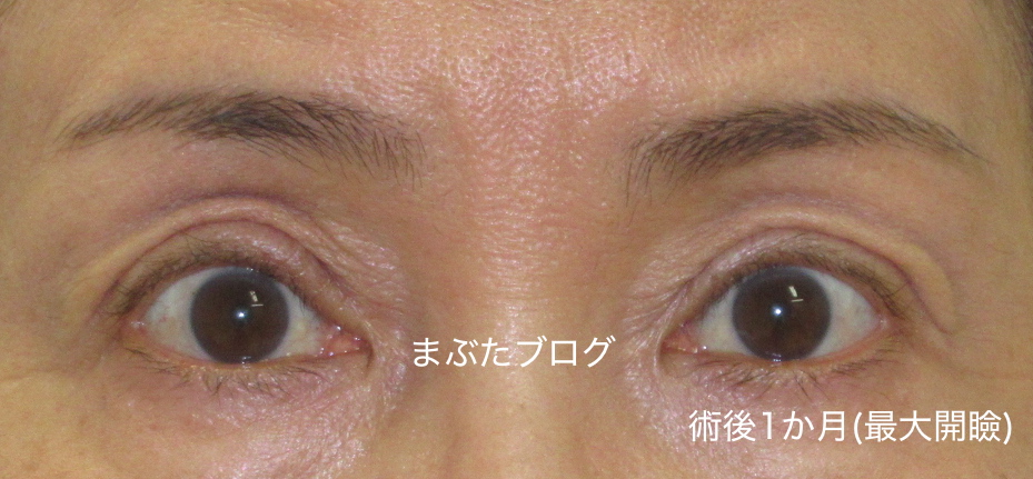 f:id:tomitooji:20200328173836j:plain