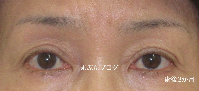 f:id:tomitooji:20200328174224j:plain
