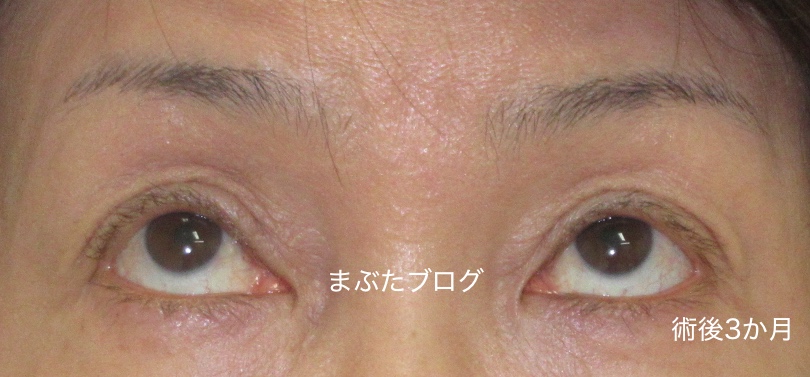 f:id:tomitooji:20200328174314j:plain
