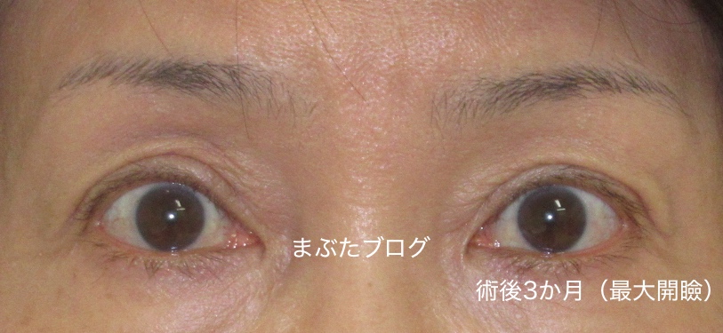 f:id:tomitooji:20200328174332j:plain