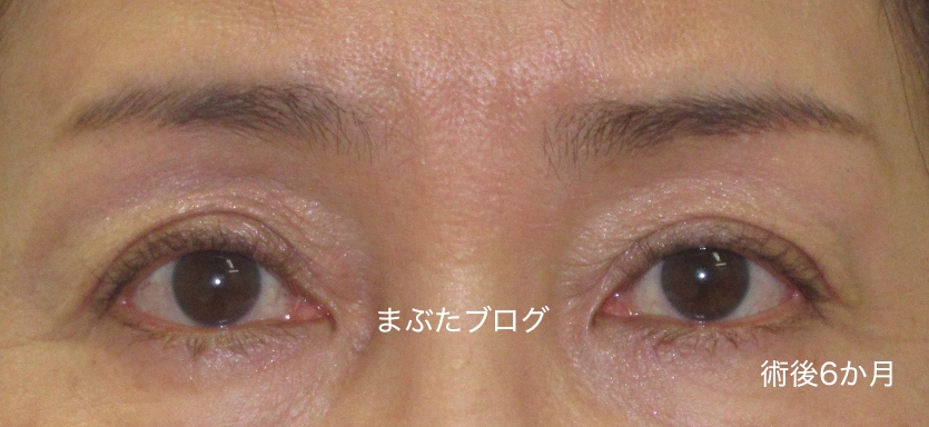 f:id:tomitooji:20200328174614j:plain