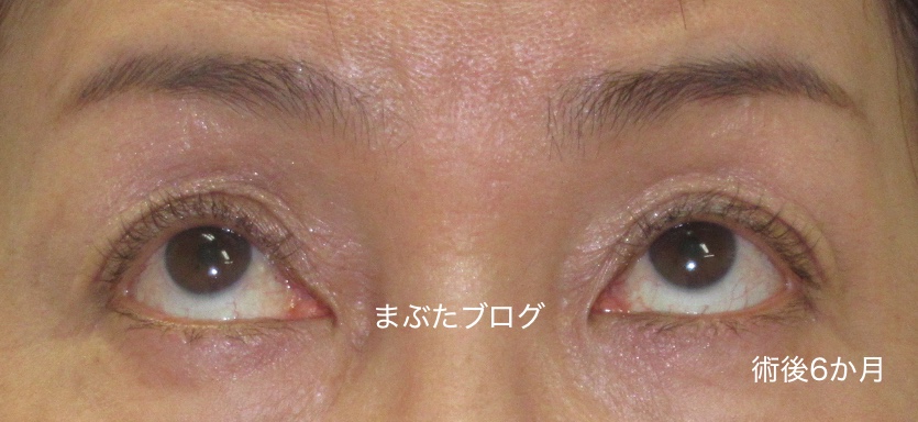 f:id:tomitooji:20200328174711j:plain