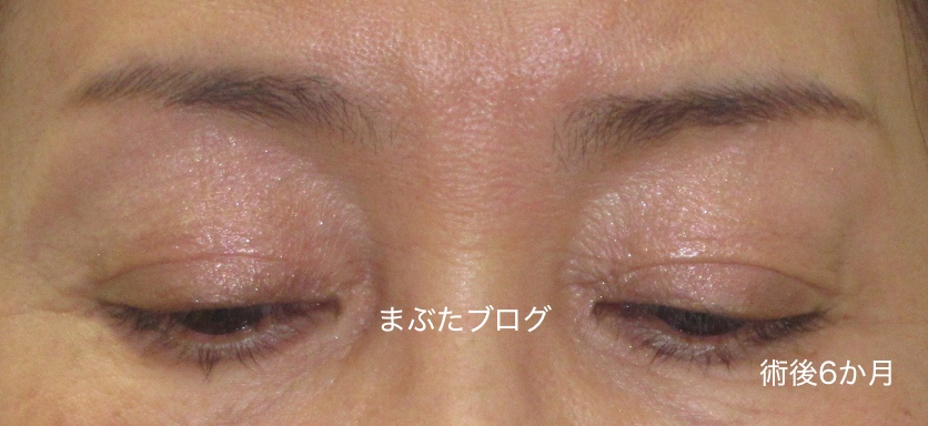 f:id:tomitooji:20200328174810j:plain
