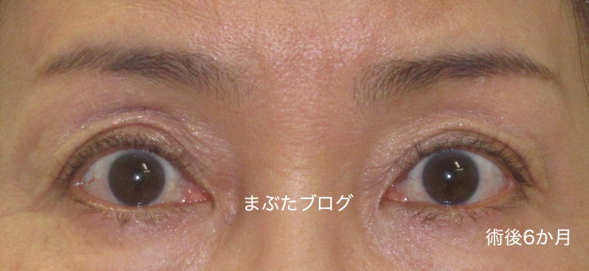 f:id:tomitooji:20200328174836j:plain