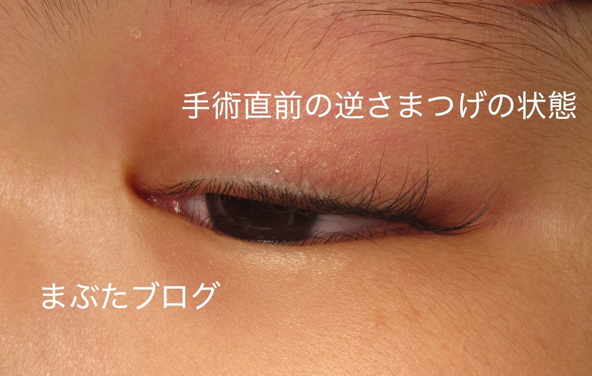 f:id:tomitooji:20200502105954j:plain