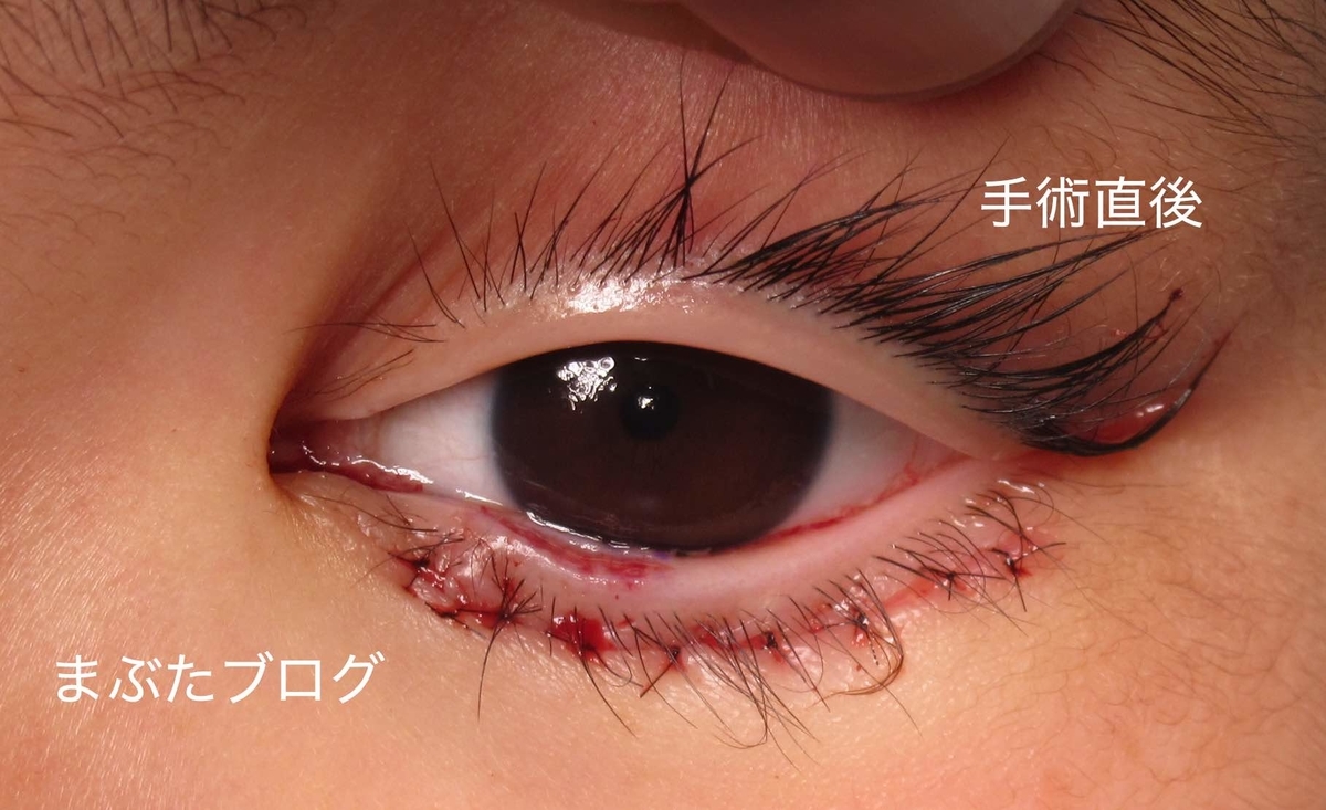 f:id:tomitooji:20200502110549j:plain