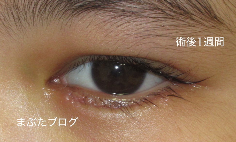 f:id:tomitooji:20200502110714j:plain
